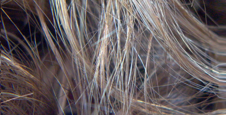 Tips to Protect Your Hair and Avoid Hair Fall